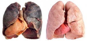 Smoker lungs and healthy